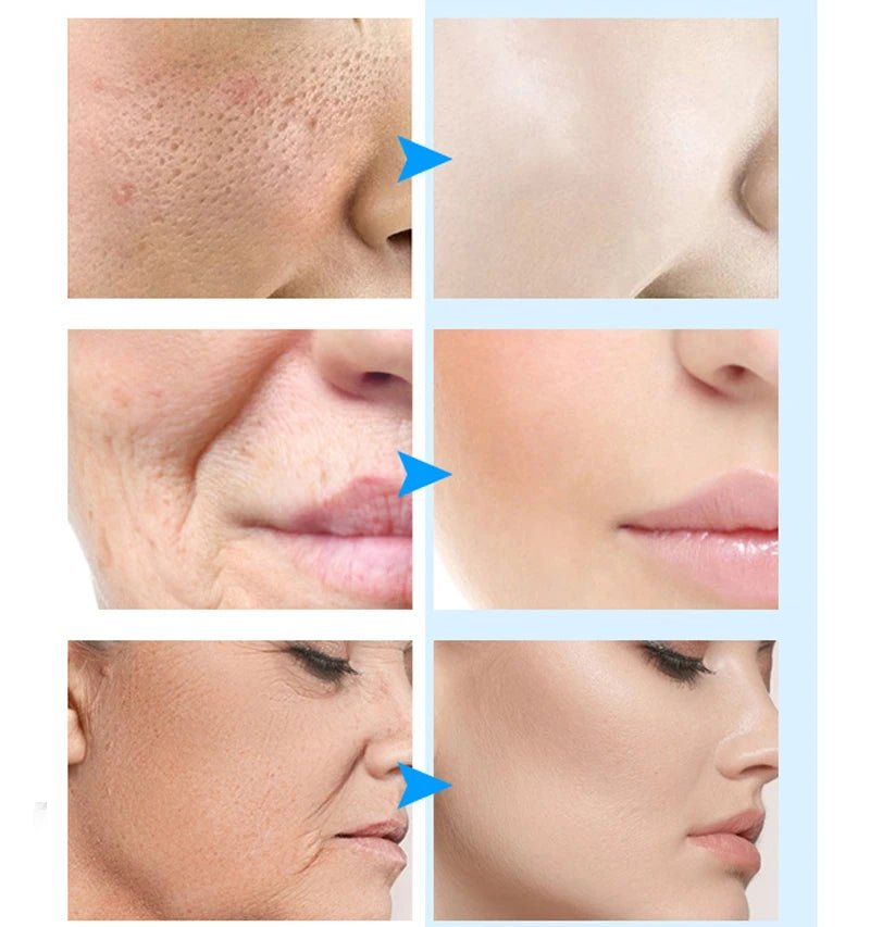 BioLift - Mascarilla Coreana de Colágeno + Regalo : Ebook El Arte Coreano del Cuidado de la Piel. - Hogar Elegance